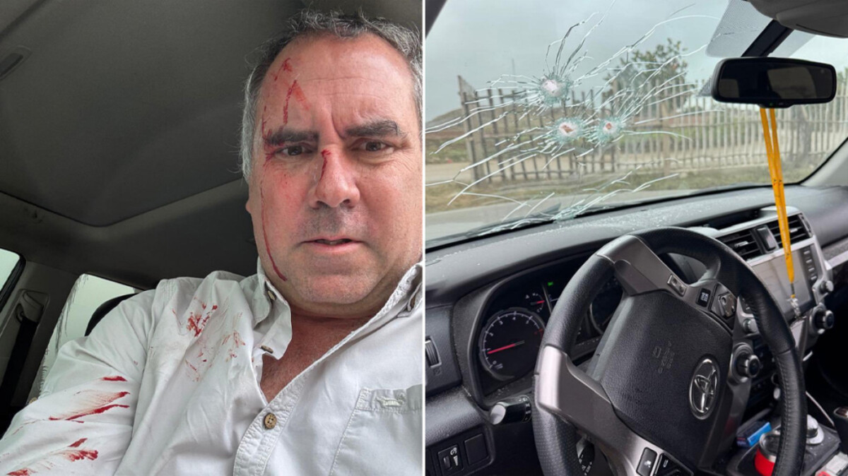 Kandidati për zgjedhjet presidenciale sulmohet me armë zjarri  Publikohen fotot i gjakosur në fytyrë