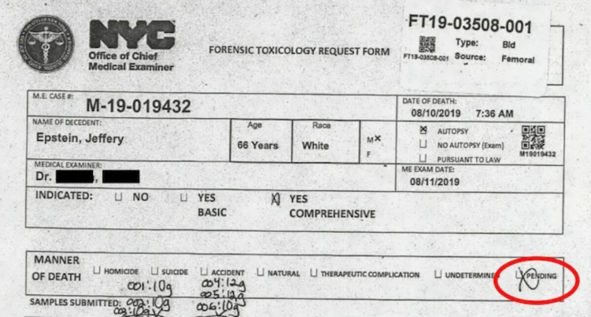 Kërkohet një riekzaminim  U vetëvra apo e mbytën  Pyetje të reja rreth vdekjes së Epstein  mjeku ngre dyshime
